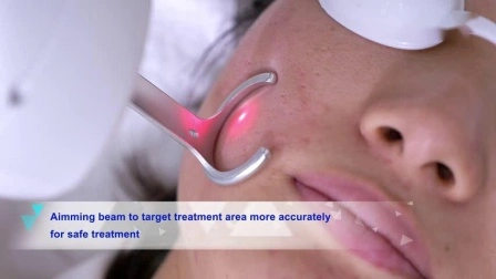 Appareil laser Erbium 1550 Appareil de beauté laser à fibre Erbium avec lampe d'origine allemande